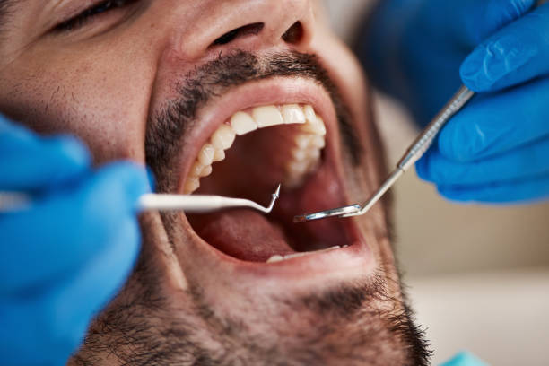 Best Emergency Dental Surgery in Goodman, MO